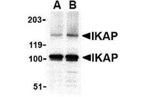 Western blot analysis of IKAP in A-20 cell lysate with AP30402PU-N IKAP antibody at in (A) 0. (IKAP/p150 抗体  (C-Term))