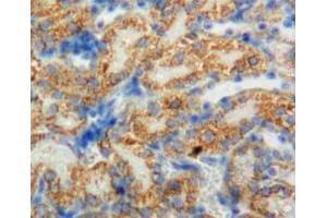 Immunohistochemistry (IHC) image for anti-Cytochrome P450, Family 11, Subfamily B, Polypeptide 1 (CYP11B1) (AA 1-498) antibody (ABIN7435544)
