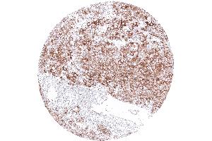 anti-Glycoprotein M6A (GPM6A) antibody