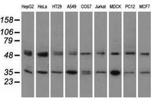 Western Blotting (WB) image for anti-Protein Kinase, CAMP-Dependent, Regulatory, Type II, alpha (PRKAR2A) antibody (ABIN2729600)