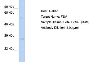 Host: Rabbit Target Name: FEV Sample Type: Fetal Brain lysates Antibody Dilution: 1. (FEV 抗体  (C-Term))