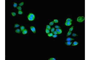Immunofluorescent analysis of PC-3 cells using ABIN7166648 at dilution of 1:100 and Alexa Fluor 488-congugated AffiniPure Goat Anti-Rabbit IgG(H+L) (ACOT6 抗体  (AA 1-207))