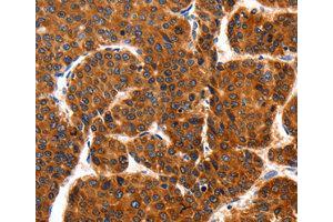 Immunohistochemistry (IHC) image for anti-TNF Receptor-Associated Protein 1 (TRAP1) antibody (ABIN1875197) (TRAP1 抗体)