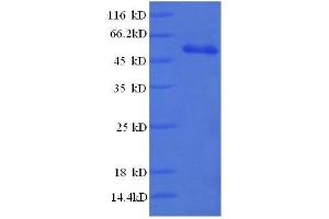 High-Mobility Group Box 1 (HMGB1) (AA 8-179), (partial) protein (GST tag)