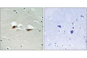 Immunohistochemistry analysis of paraffin-embedded human brain, using ATF-2 (Phospho-Ser472) Antibody. (ATF2 抗体  (pSer472))