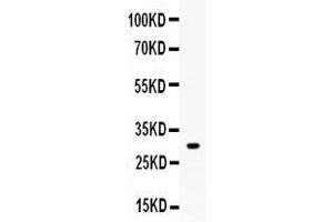 Western blot analysis of ZWINT expression in rat skeletal muscle extract ( Lane 1). (ZWINT 抗体  (AA 29-249))