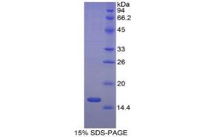 SDS-PAGE analysis of Cow ACVR2A Protein. (ACVR2A 蛋白)