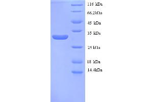 SDS-PAGE (SDS) image for Metallothionein 1E (MT1E) (AA 4-59), (partial) protein (GST tag) (ABIN5713084) (MT1E Protein (AA 4-59, partial) (GST tag))