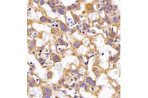 Immunohistochemistry (IHC) image for anti-Chloride Intracellular Channel 6 (CLIC6) antibody (ABIN7073478)