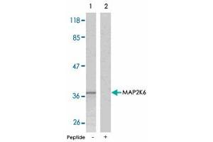 Western blot analysis of extracts from MDA-MB-435 cells using MAP2K6 polyclonal antibody . (MAP2K6 抗体  (Ser207))