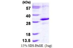 Egl-9 Family Hypoxia Inducible Factor 3 (EGLN3) (AA 1-239) protein (His tag)