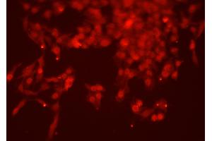 ABIN6263769 and ABIN6277767 staining HEPG2 cells by ICC/IF.