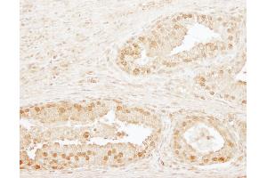 Immunohistochemistry (IHC) image for anti-Cleavage and Polyadenylation Specific Factor 3, 73kDa (CPSF3) (AA 1-50) antibody (ABIN7454528)