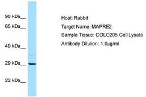 Image no. 1 for anti-Microtubule-Associated Protein, RP/EB Family, Member 2 (MAPRE2) (AA 157-206) antibody (ABIN6750058) (MAPRE2 抗体  (AA 157-206))