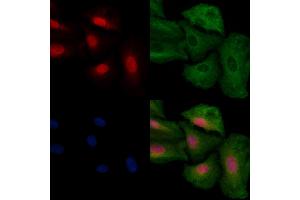 ABIN6260893 and ABIN6278559 staining  cells by IF/ICC.