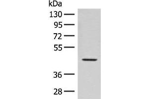Western blot analysis of Hela cell lysate using FAM50A Polyclonal Antibody at dilution of 1:300 (FAM50A 抗体)