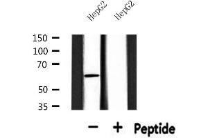 Western blot analysis of extracts from HepG2, using SGOL1 Antibody. (Shugoshin 抗体  (N-Term))