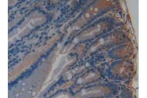 Detection of PAI1 in Rat Rectum Tissue using Polyclonal Antibody to Plasminogen Activator Inhibitor 1 (PAI1) (PAI1 抗体  (AA 24-402))