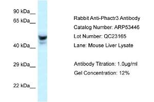 Western Blotting (WB) image for anti-Phosphatase and Actin Regulator 3 (PHACTR3) (Middle Region) antibody (ABIN2785397) (PHACTR3 抗体  (Middle Region))