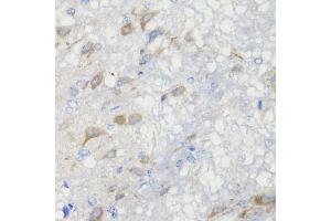 Immunohistochemistry of paraffin-embedded rat brain using CHIC2 antibody (ABIN5974773) at dilution of 1/100 (40x lens). (CHIC2 抗体)