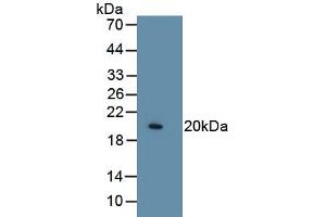 Western Blotting (WB) image for anti-Collagen, Type VIII, alpha 1 (COL8A1) (AA 575-743) antibody (ABIN7426484)