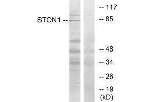Western blot analysis of extracts from K562 cells, using STON1 antibody. (STON1 抗体  (C-Term))