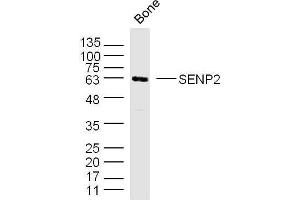 Mouse bone lysates probed with SENP2 Polyclonal Antibody, unconjugated  at 1:300 overnight at 4°C followed by a conjugated secondary antibody for 60 minutes at 37°C. (SENP2 抗体  (AA 1-100))
