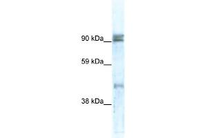 WB Suggested Anti-ZNF227 Antibody Titration:  0. (ZNF227 抗体  (N-Term))