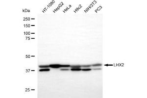 anti-LIM Homeobox 2 (LHX2) antibody