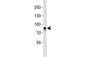 Western blot analysis of lysate from MCF-7 cell line using BRAF antibody.