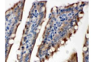 IHC analysis of SULT2B1 using anti-SULT2B1 antibody (ABIN3043414).