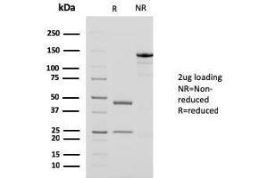 SDS-PAGE Analysis Purified Smooth Muscle Actin MAb (1A4 + ACTA2/791). (Smooth Muscle Actin 抗体  (N-Term))