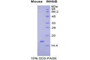 SDS-PAGE analysis of Mouse Inhibin beta B Protein. (INHBB 蛋白)