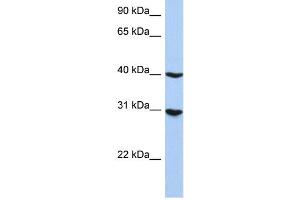WB Suggested Anti-IRF1 Antibody Titration: 0. (IRF1 抗体  (N-Term))