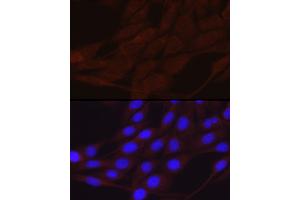 Immunofluorescence analysis of NIH/3T3 cells using SCNN1A Rabbit pAb (ABIN6129465, ABIN6147447, ABIN6147448 and ABIN6221186) at dilution of 1:200 (40x lens). (SCNN1A 抗体  (AA 105-225))