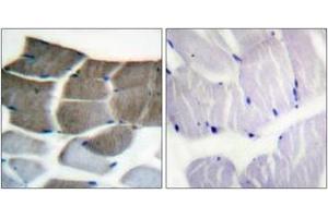 Immunohistochemistry analysis of paraffin-embedded human skeletal muscle tissue, using ACC1 (Ab-80) Antibody. (Acetyl-CoA Carboxylase alpha 抗体  (AA 46-95))