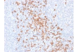Formalin-fixed, paraffin-embedded human Tonsil stained with CD8 Mouse Recombinant Monoclonal Antibody (rC8/468). (Recombinant CD8 alpha 抗体)
