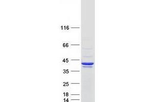Western Blotting (WB) image for Microtubule-Associated Protein, RP/EB Family, Member 2 (MAPRE2) (Transcript Variant 1) protein (Myc-DYKDDDDK Tag) (ABIN2725484)