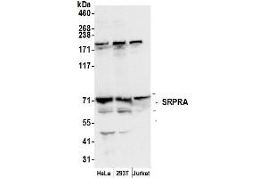 anti-Signal Recognition Particle Receptor Subunit alpha (SRPRA) (AA 125-175) antibody