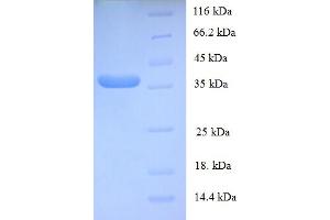 SDS-PAGE (SDS) image for General Transcription Factor IIE, Polypeptide 2 (GTF2E2) (AA 1-291), (full length) protein (His tag) (ABIN5709625)