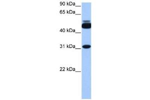 Western Blotting (WB) image for anti-Cylicin, Basic Protein of Sperm Head Cytoskeleton 2 (CYLC2) antibody (ABIN2459690)