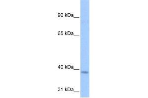 WB Suggested Anti-NSUN3 Antibody Titration:  0.
