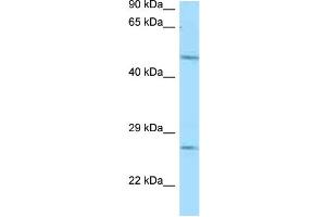WB Suggested Anti-Entpd1 Antibody Titration: 1. (CD39 抗体  (N-Term))