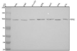 Western blot analysis of ROR2 using anti-ROR2 antibody (ABIN7606204).