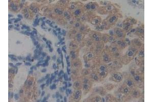 Detection of TRAF2 in Mouse Liver Tissue using Polyclonal Antibody to TNF Receptor Associated Factor 2 (TRAF2) (TRAF2 抗体  (AA 238-491))