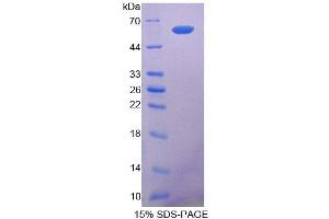 SDS-PAGE analysis of Dog COL1A2 Protein. (COL1A2 蛋白)