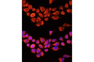 Immunofluorescence analysis of 293T cells using AADAC antibody (ABIN6129182, ABIN6136311, ABIN6136313 and ABIN6218113) at dilution of 1:100 (40x lens). (AADAC 抗体  (AA 170-399))