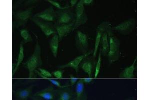 Immunofluorescence analysis of U-2 OS cells using CAMLG Polyclonal Antibody at dilution of 1:100 (40x lens). (CAMLG 抗体)