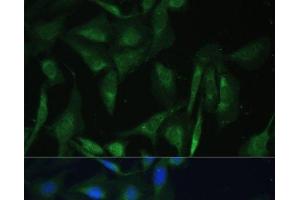 Immunofluorescence analysis of U-2 OS cells using CAMLG Polyclonal Antibody at dilution of 1:100 (40x lens). (CAMLG 抗体)