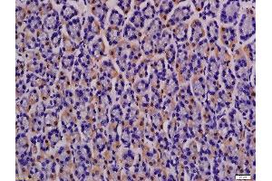 Immunohistochemistry (Paraffin-embedded Sections) (IHC (p)) image for anti-Solute Carrier Family 16 (Monocarboxylic Acid Transporters), Member 3 (SLC16A3) (AA 401-465) antibody (ABIN749303)